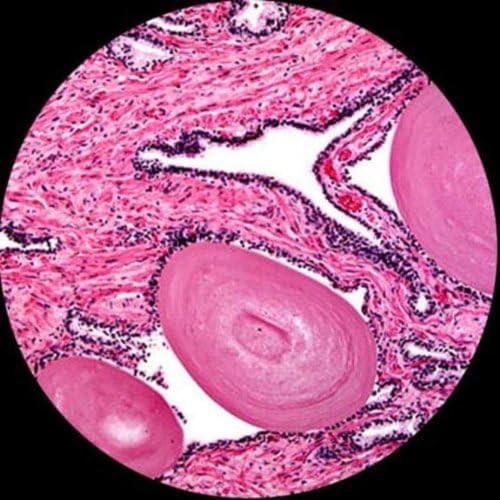 AmScope T360B-10M Digital Trinocular Compound Microscope 40X-2000X White