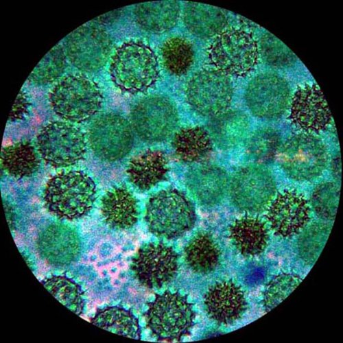 AmScope Digital Trinocular Compound Microscope 40X-2500X with 5MP Camera