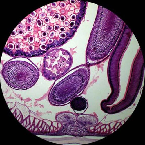 AmScope Digital Trinocular Compound Microscope 40X-2500X with 5MP Camera