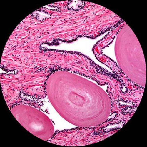 AmScope M620B-8M Digital Monocular Microscope 40x-2000x LED 8MP Camera