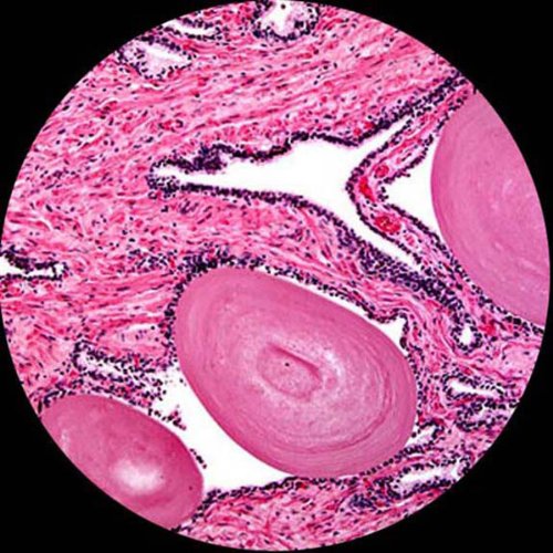 AmScope Digital Trinocular Compound Microscope 40X-2500X Magnification